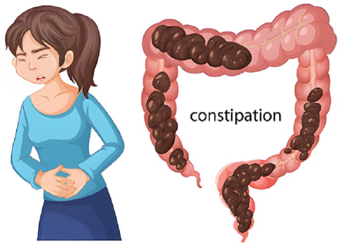Best Doctor for Acidity and Constipation in Byculla